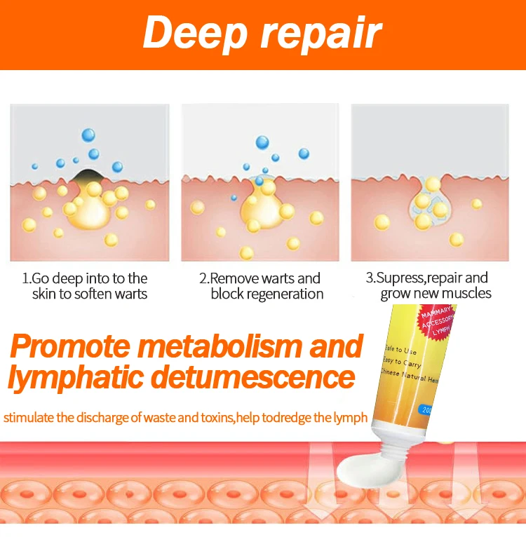 Customized Lymphatic Massage Plant Herbal Materials Underarm And Neck Lymphatic Cream Buy