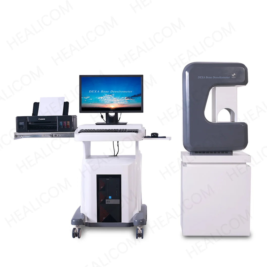 Bone Densitometry Equipment X Ray Bone Densitometer Preventing Osteoporosis Dual Energy DEXA Absorptiometry