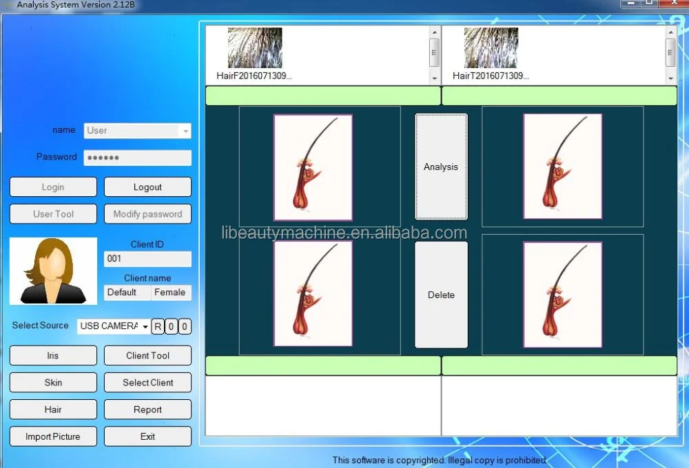 Eye Iridology8