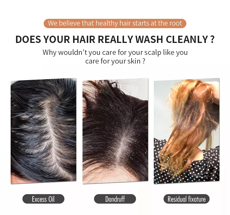 Private Label Pepermint Relief Scalp Cleaning Scrub Vegan Hair