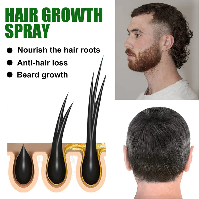 Anti-hair Loss Hair Growth Spray Men Rosemary Plant Essence Hair Growth