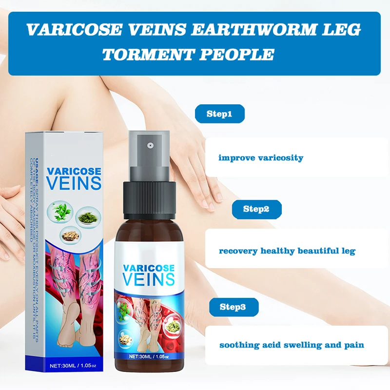 Hot Sell Varicose Veins Remover Treatment Spray For Veins Earthworm Leg Torment 30ml Buy