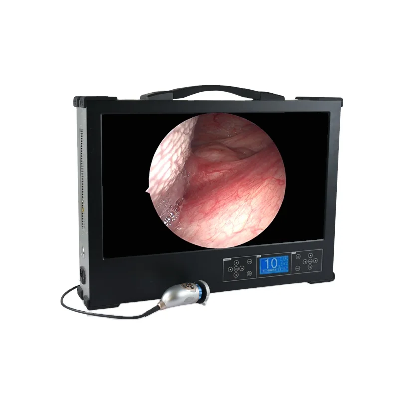 3 in 1 Integrated Endoscope Camera Used for Rigid Endoscopes