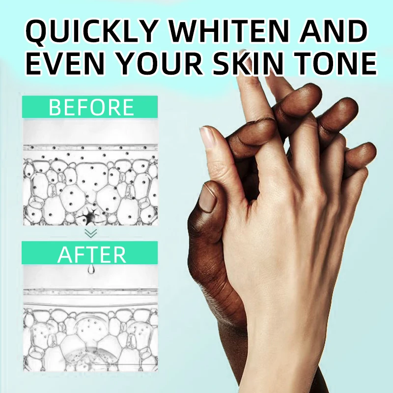Private Label Organic Milk Serum 5 Days Dark Knuckle Eraser Oil Remover Moisturizing Brightening Whitening Serum