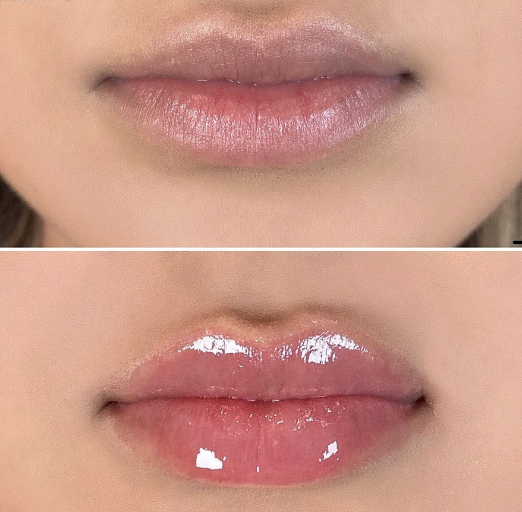 Strong Effect Version Lip Booster High Quality Custom Logo Hyaluronic
