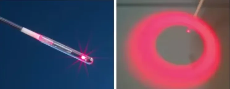 1470nm Endovascular Diode Laser Ablation Evlt 980nm Endovenous Medical  Laser Varicose Veins Spider Veins in Legs Laser Ablation