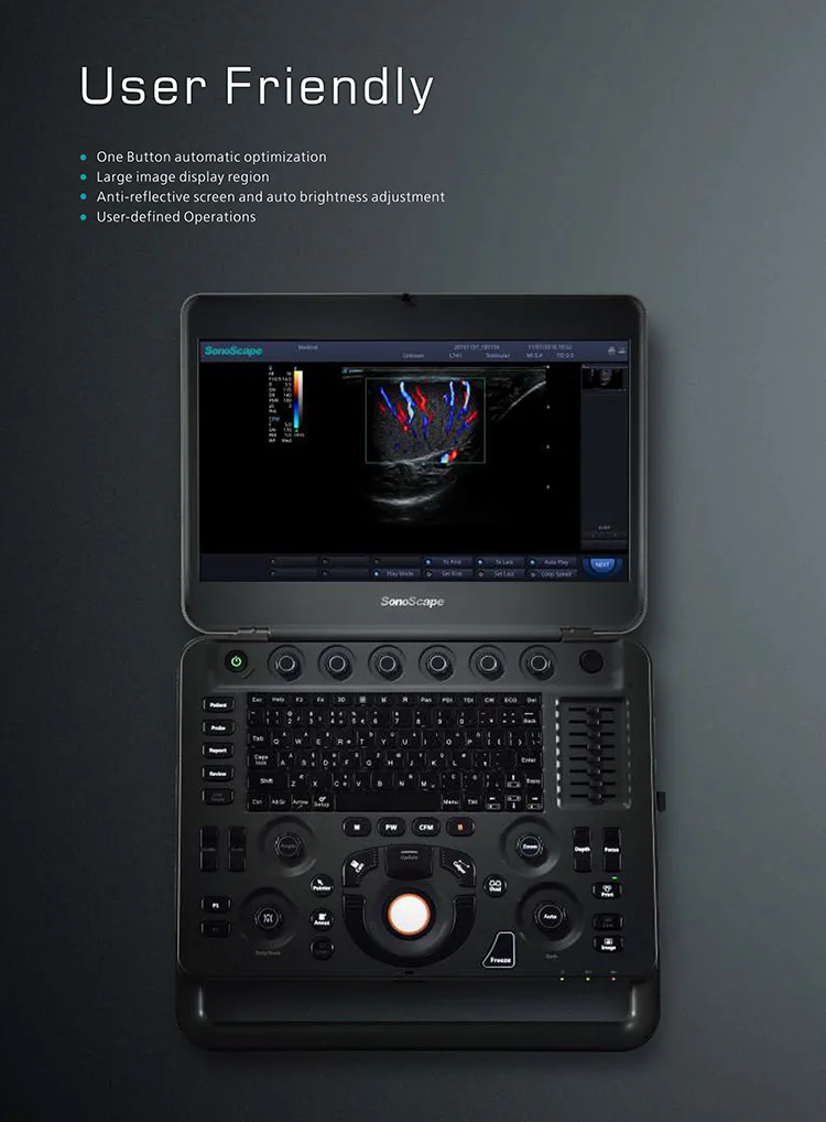 Sonoscape X5 B/ 2B/ 4B/ M/ Gynecology cardiology testing color doppler portable ultrasound with Probe