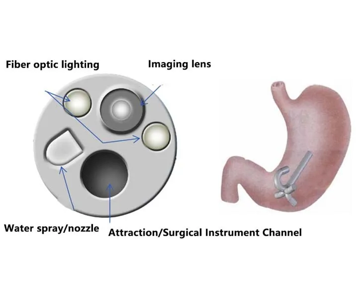 Medical Endoscope Camera Gastroscopy System Endoscope System Machine ...