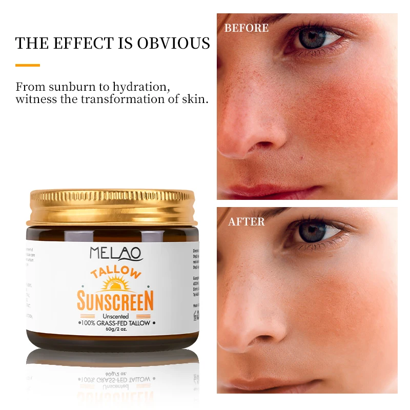 MELAO Safe Sunscreen Tallow Sun Balm Beef Tallow Sunscreen for Kids Men Women Skin Care Sunscreen Lotion Cream
