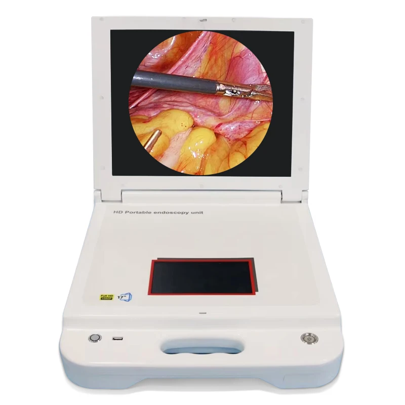 Portable Surgical Medical Endoscopic Camera System for Laparoscopic Laparoscopy Ent Arthroscopic Arthroscopy
