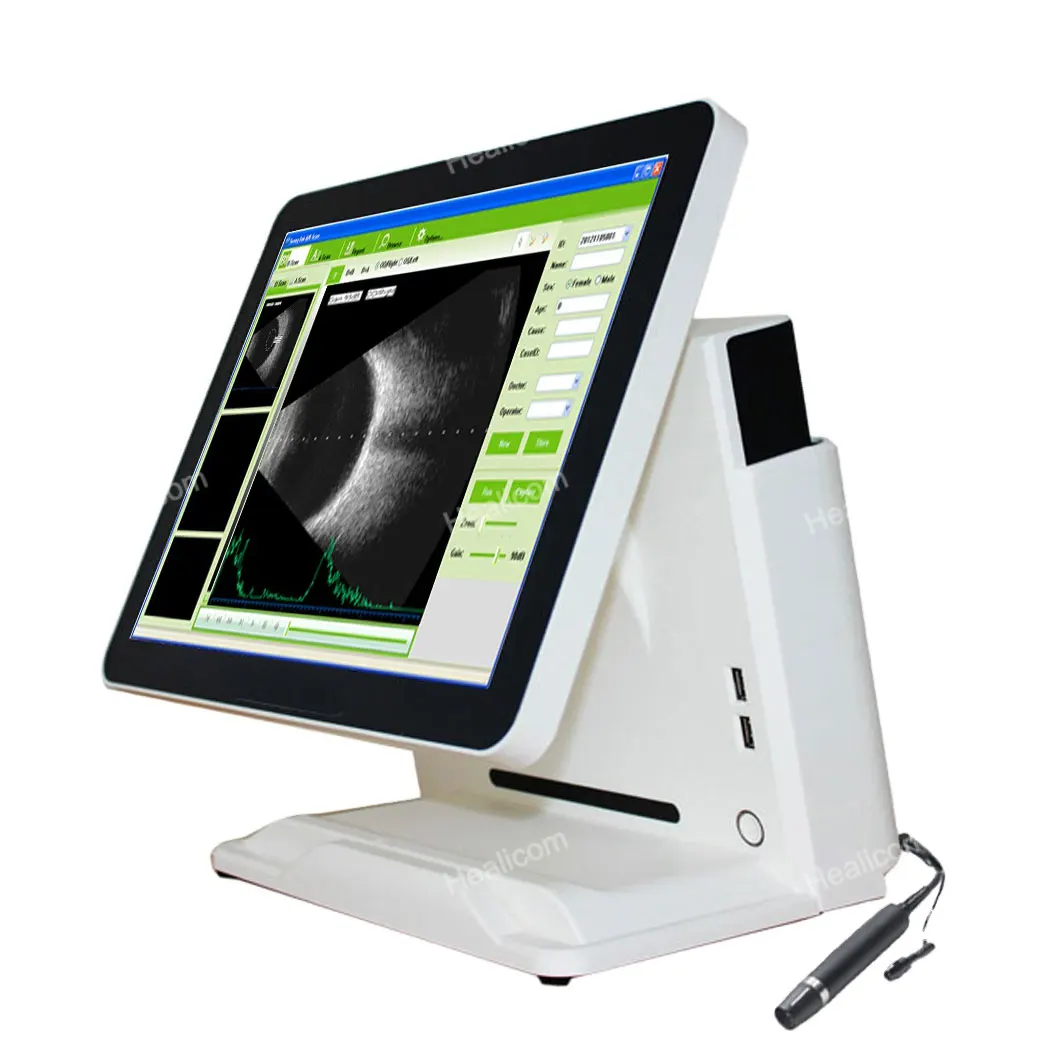 Hot Sale Ophtalmology Equipment Portable a / B Scan Ophthalmic Ultrasound Machine Ophthalmic Ultrasound A/B Scanner