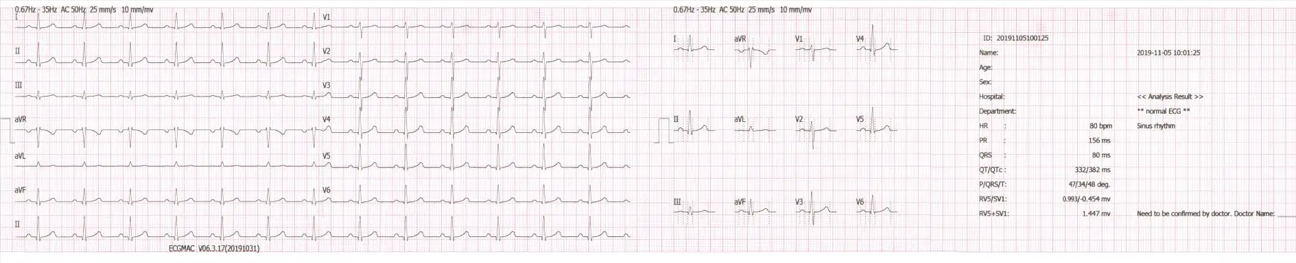 6-канальный ЭКГ машина ecg портативный электрокардиограф/ЭКГ машина CE ISO Сертифицированный