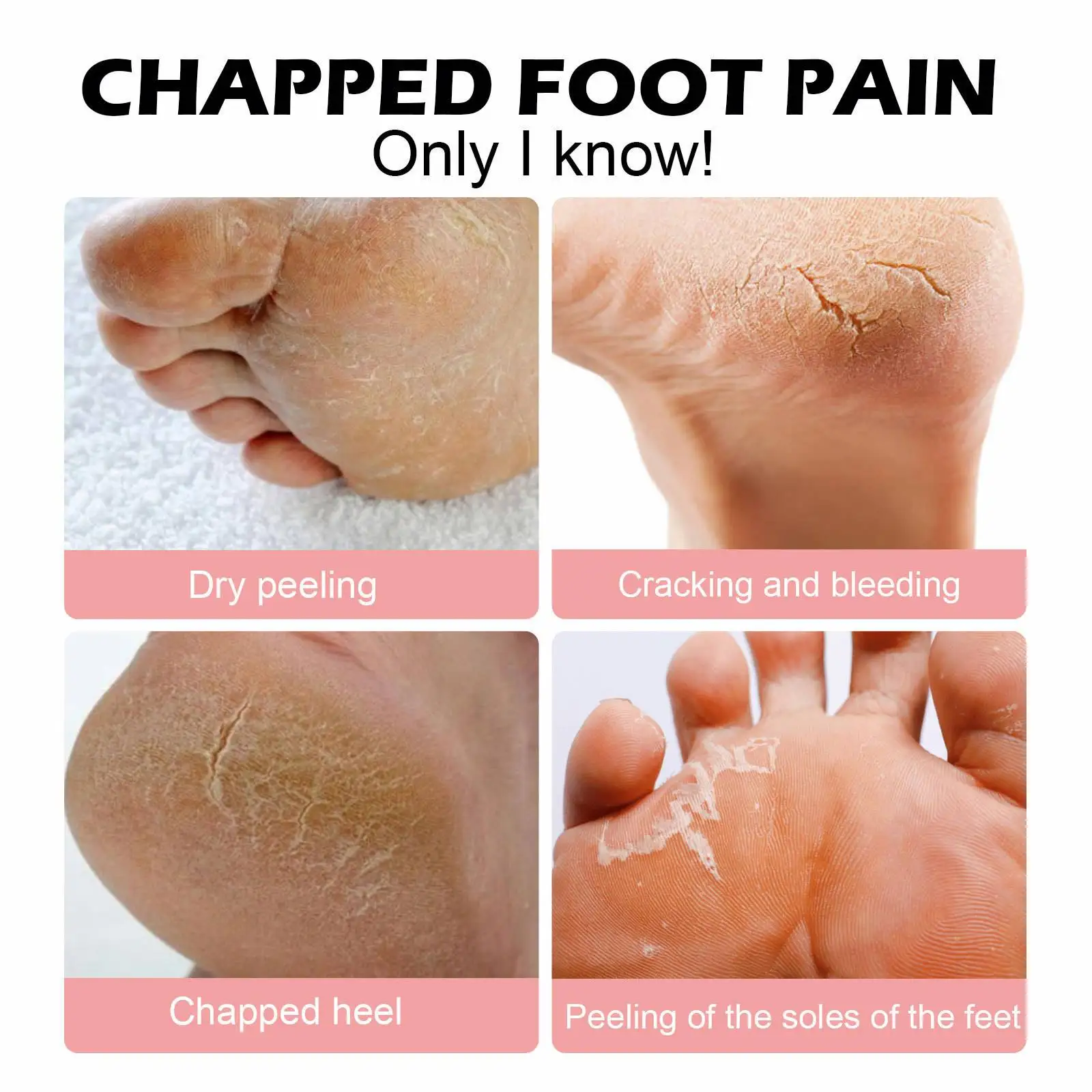 What Causes Feet Cracking And Bleeding Sale Feet Dry Cracked And