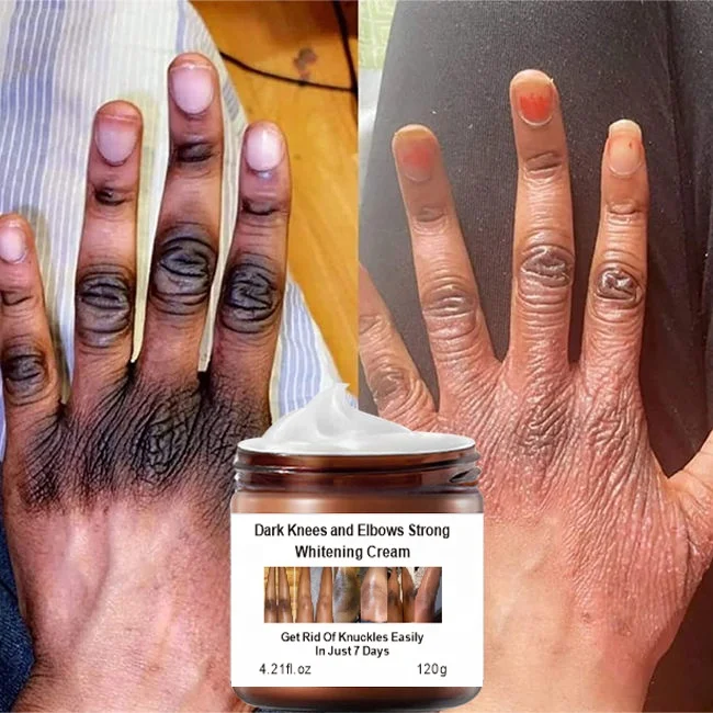 Crème éclaircissante Intense Pour Genoux, Coudes Et Pieds - Traitement De Nuit - Neuf - Fabriqué En France