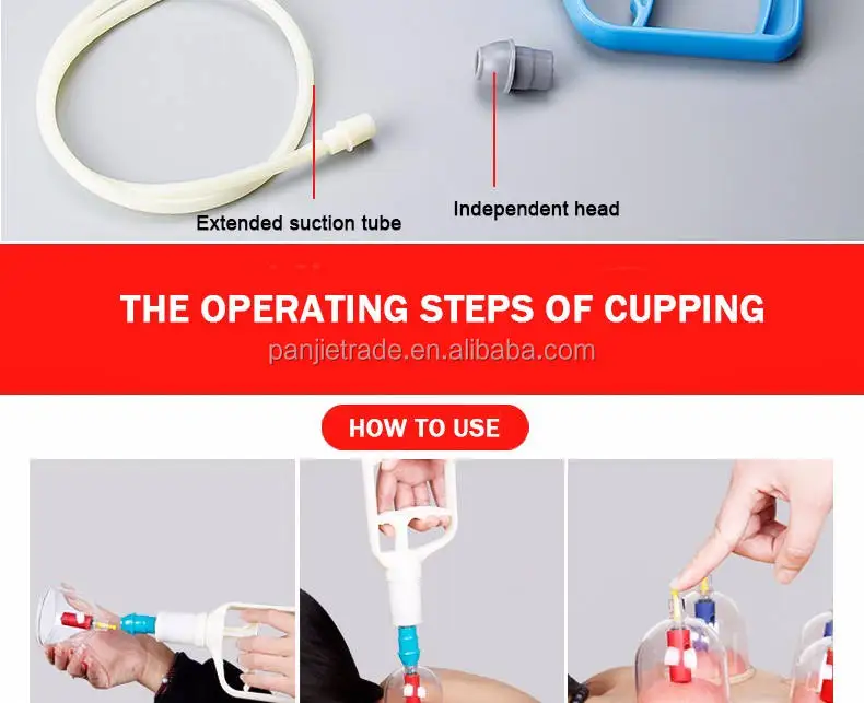 Direct Single Cupping Cupstherapy Vacuum Suction Massage Cup Cupping ...