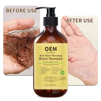 Reduce Hair Loss Product Private Label Guangzhou Factory Manufacturer Wholesale Organic Herbal Hair Care Anti Hair Loss Shampoo