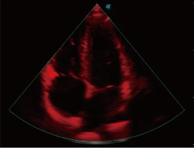 Sonoscape P20 Mobile 3D/4D Real-time Color Panoramic Doppler Trolley Ultrasound Machine manufacture
