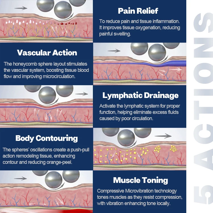 <h3 class="features--headline">Features and benefits</h3> <ul> <li><strong>High-Performance Cellulite Removal</strong>: Effectively smooths out uneven skin and visibly diminishes the appearance of cellulite, leaving clients with a toned and contoured silhouette.</li> <li><strong>Multi-Level Intensity Settings</strong>: Customizable to cater to various skin types and treatment areas, from gentle facial massages to deep-tissue body sculpting.</li> <li><strong>Enhanced Lymphatic Drainage</strong>: Promotes natural detoxification by improving circulation and boosting metabolic activity, reducing fluid retention and bloating.</li> <li><strong>Relaxing, Painless Treatment</strong>: Combines therapeutic massage with cutting-edge technology to deliver a soothing experience that feels indulgent yet transformative.</li> </ul> <hr /> <span class="tw-text-2xl tw-font-bold" style="color: #99ccff;">1 YEAR WARRANTY + 3 YEAR TECH SUPPORT</span> <span class="tw-text-2xl tw-font-bold" style="color: #99ccff;">30 DAY MONEY-BACK AND <a href="https://salonmachines.com/refund_returns/">RETURN POLICY</a></span> <span class="tw-text-2xl tw-font-bold" style="color: #99ccff;">FREE WORLDWIDE SHIPPING <a href="https://salonmachines.com/shipping-policy/">SHIPPING POLICY</a></span> <span class="tw-text-2xl tw-font-bold" style="color: #99ccff;">PROFESSIONAL BEAUTY <a href="https://salonmachines.com/">SALON MACHINES</a> EQUIPMENT</span> Professional Endospheres Cellulite Reduction & Body Contouring Machine