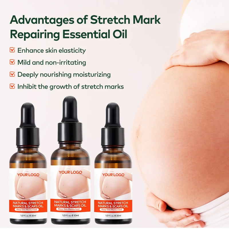 Private Label Natural Marks & Scars Repair Skin Nourishing Smoothing Message Oil Natural Stretch Mark Oil(pic1)