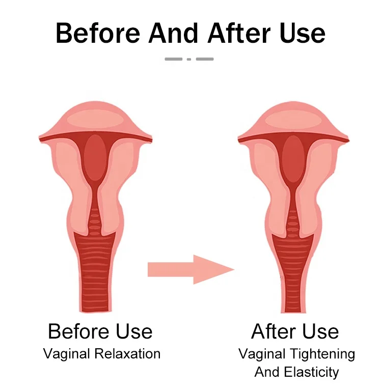 Vagina ichida juda kop sperma Vagina ichida juda kop sperma