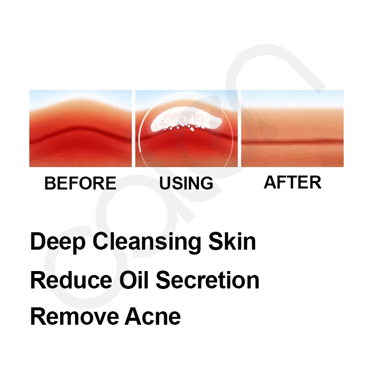 Activated Exfoliating Body Facial Scrub Natural Organic Charcoal Scrub