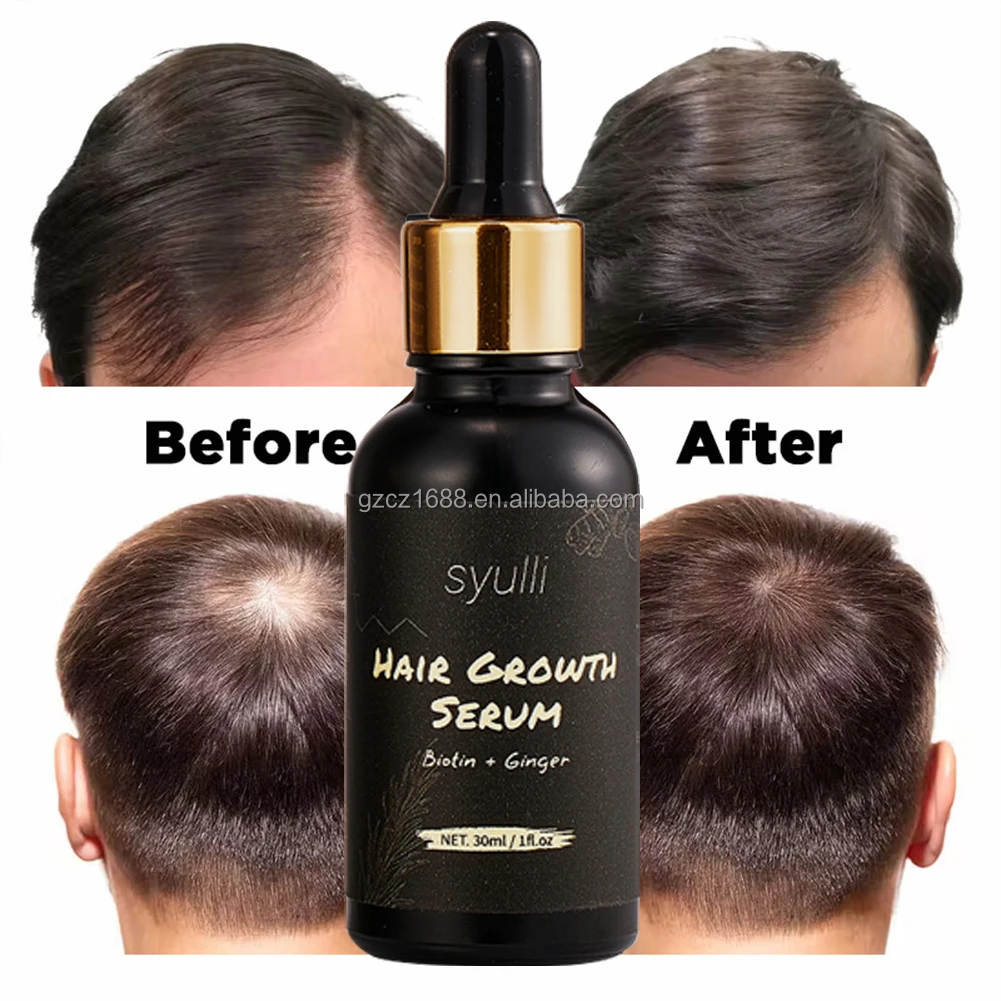 Hair Growth Serum Oil Biotin Regrowth Treatment For Scalp Hair Loss ...