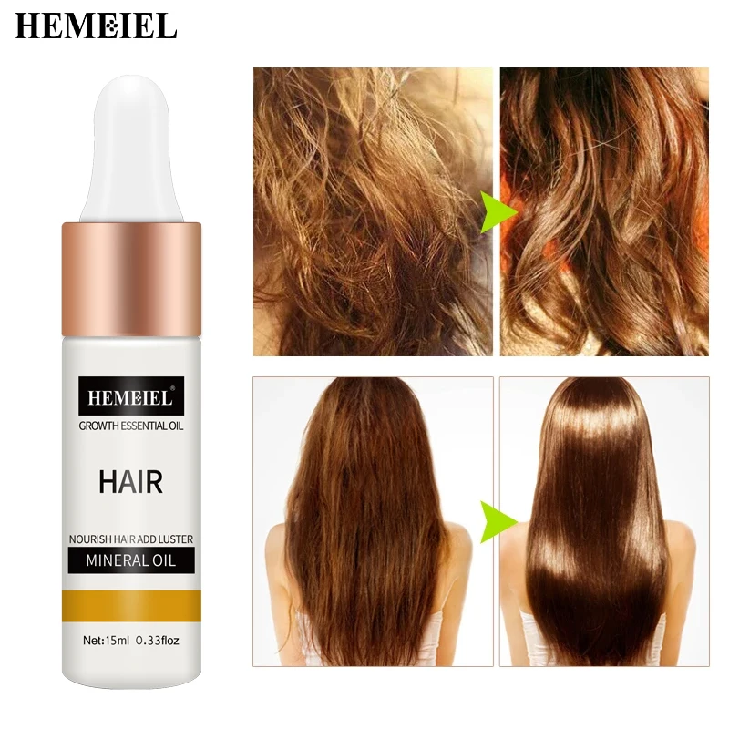 Женское и мужское средство против выпадения волос Органическая травяная Сыворотка для роста натуральная Фирменная торговая марка травяное лучшее