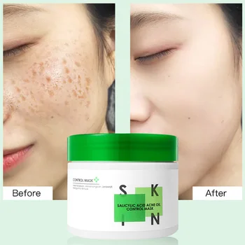 smooth moisturizing nourishing face mask for skin care hydrating firming tender Salicylic ACid Acne Oil Control Mask