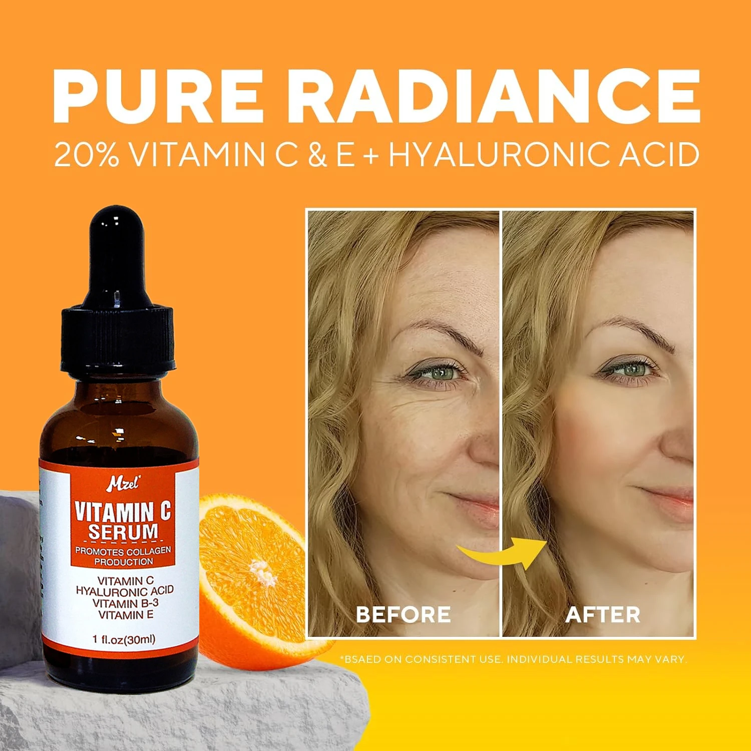 Vitamin C Skin Care Serum - Anti Aging & Brightening