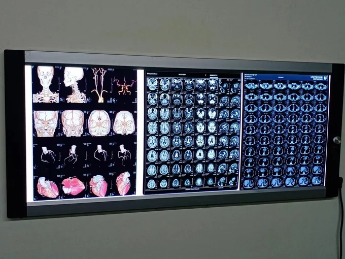 Medical Printing Film Waterproof Laser Blue X-ray Film for Hospital Radiology Department