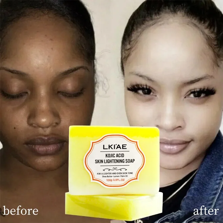 glutathione soap melasma & Dark Spot Skin Care Hyperpigmentation Solutions Glutathione Oral Liquid for Melasma