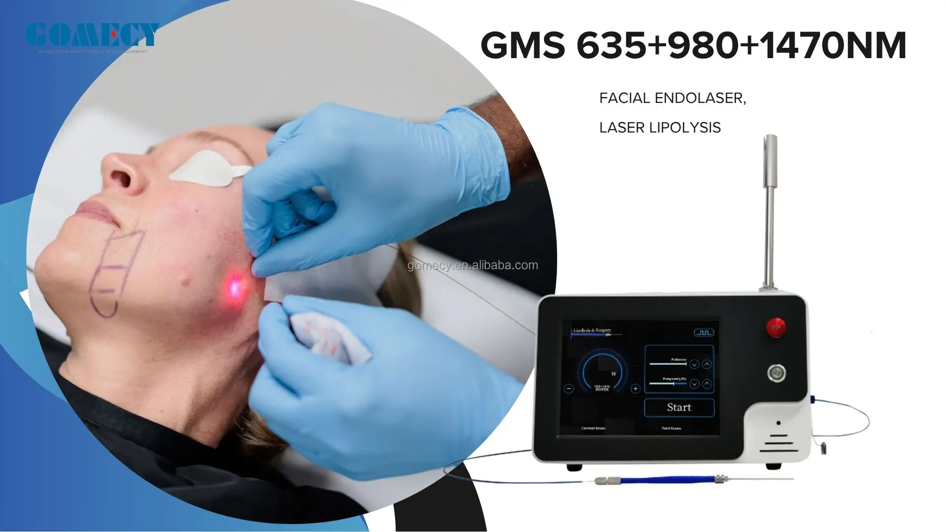 2026 Endolaser Machine Face Lifting Laser 635nm 1470nm 980nm 3 ...
