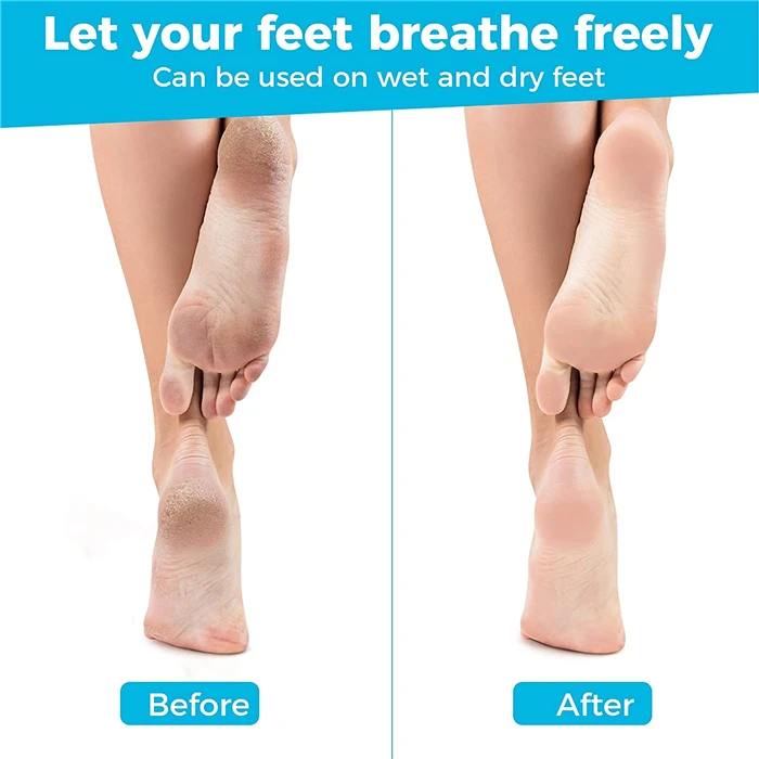 Callus Remover 5.jpg