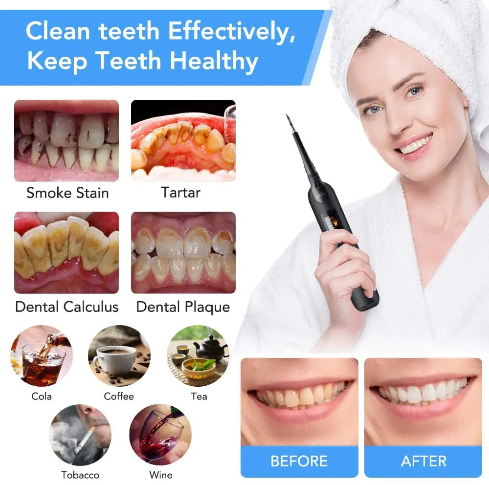 teeth cleaner (19)