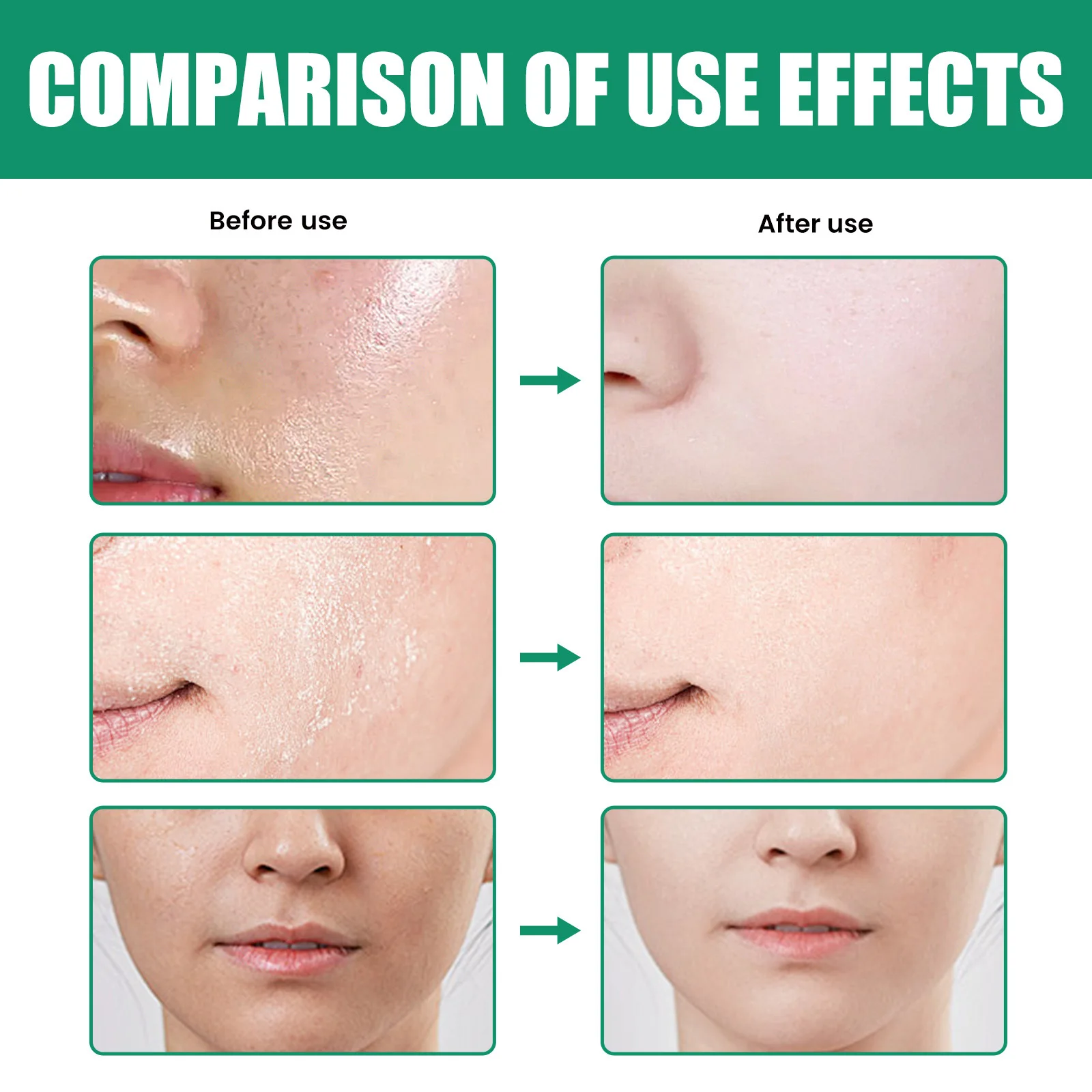 EELHOE Deep Cleansing Soothing Oil Control Repairing Natural Centella Asiatica Face Wash Facial Cleanser 100ml