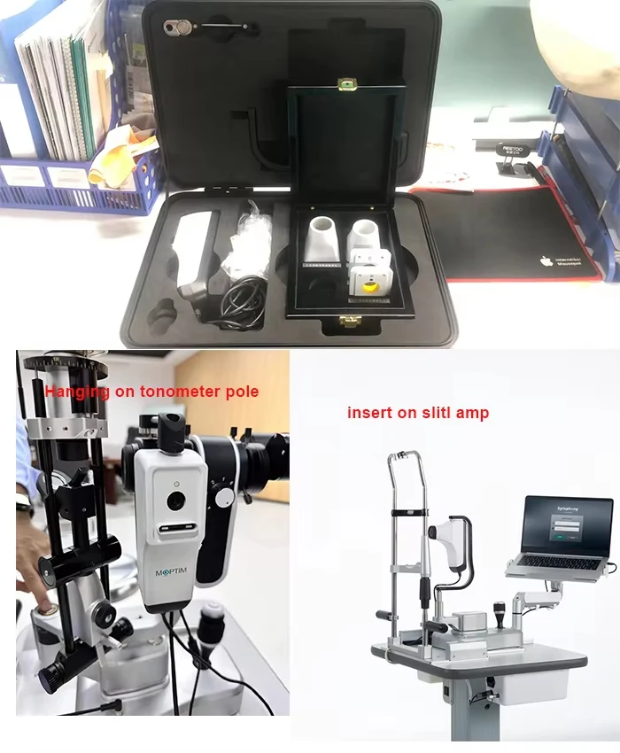 Ophthalmic Dry Eye Analyzer Dry Eye Examination Surface Analyzer Complete Dry Eye Diagnosis
