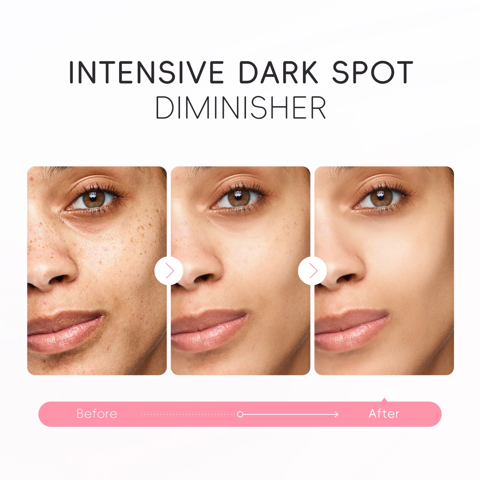 LAIKOU Japan Sakura Dark Spot Corrector - 50g Cream
