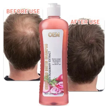 Distributor Shampoo OEM ODM Organic Onion Shampoo 500Ml Boosts Hair Density Red Onion Shampoo For Hair Loss And Thinning Hair