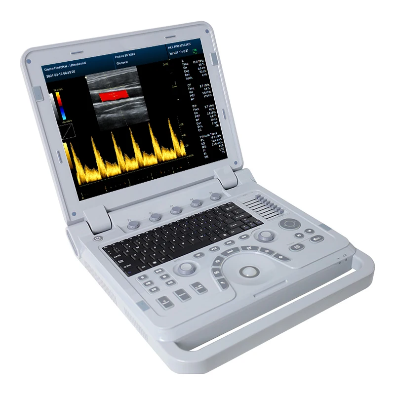 CONTEC CMS1700B-VET Veterinary Instruments for Pregnancy test Detector Portable Ultrasound Scanner V16