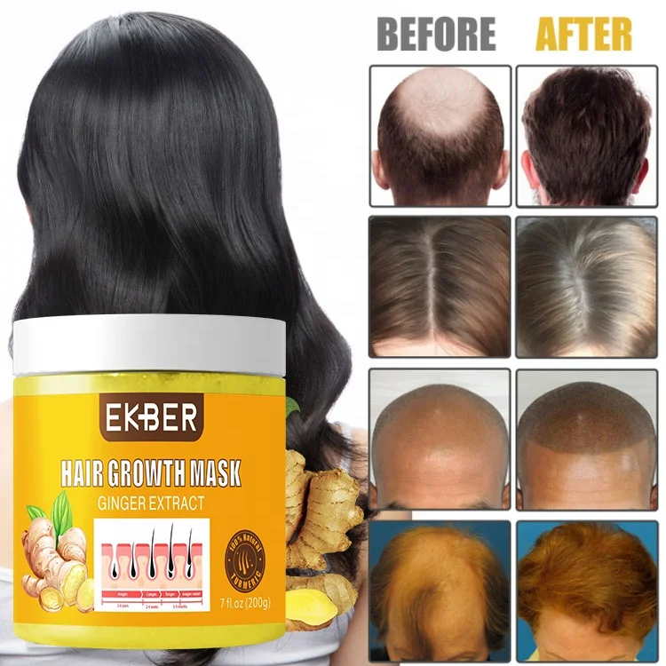 Customize Logo Multifunctional Ekber Ginger 200ml 5 Days Hair Growth Mask Hyaluronic Acid Moisturizing Refreshing Hair Care
