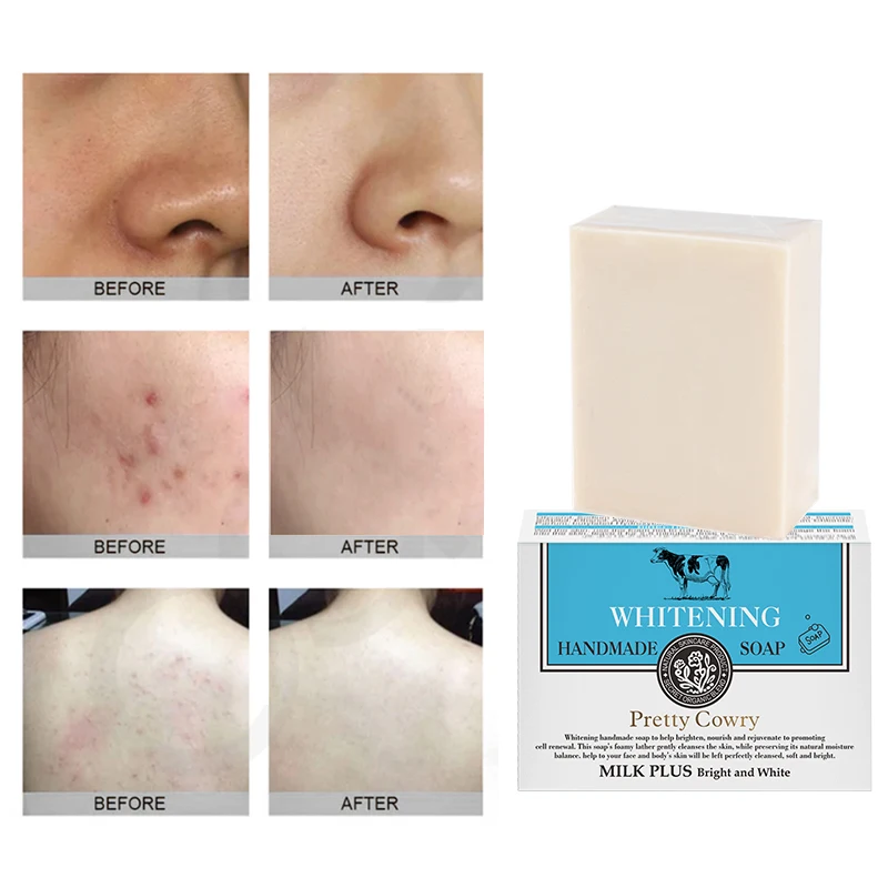 Anti Acne Handmade Exfoliating Whitening Soap For Face And Body Buy