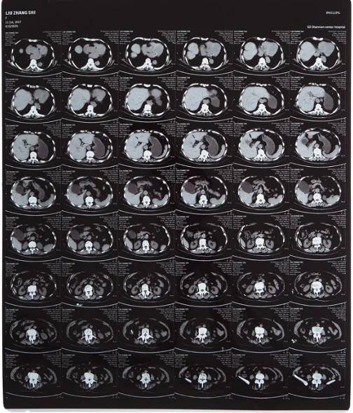 Hoge helderheid medische röntgenfilm FUJI DIHT 14*17in Laser Dry Imaging Film 2