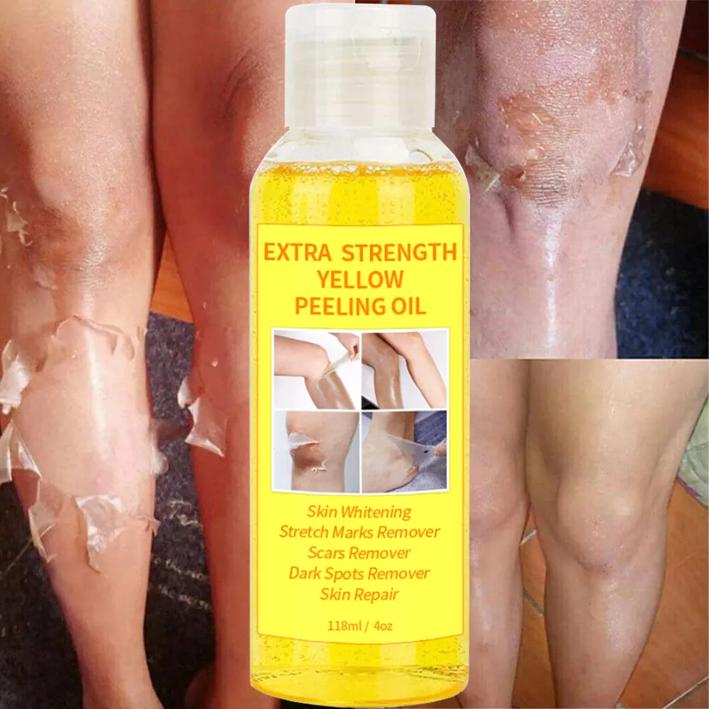Huile De Peeling YOLLOW PEELING EXTRA FORTE - 110 Ml, Originale, Fabriquée En Suisse