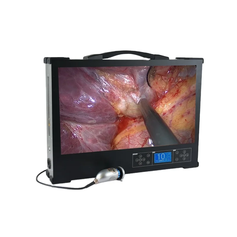 3 in 1 Integrated Endoscope Camera Used for Rigid Endoscopes