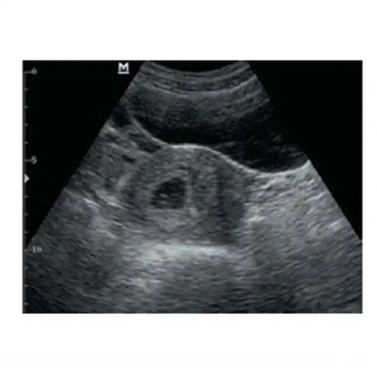 Mindray DP-20 Medical Full Digital Ultrasound Scanner Price 3d 4d Portable Ultrasound Machine
