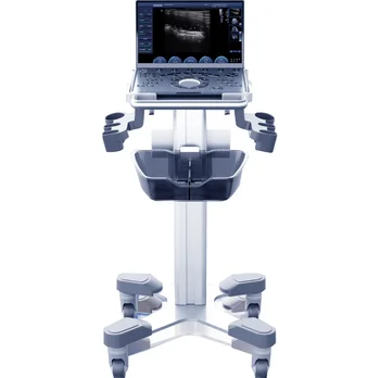 Chison SonoAir70 Redefine the Future of Portable Ultrasound perfect combination of powerful and good quality