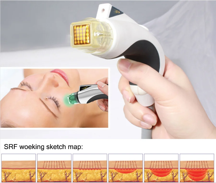 2023 No Needle Fractional Rf System Skin Rejuvenation Fractional Flx Cpt Machine Radio Frequency Microneedle Beauty Equipment