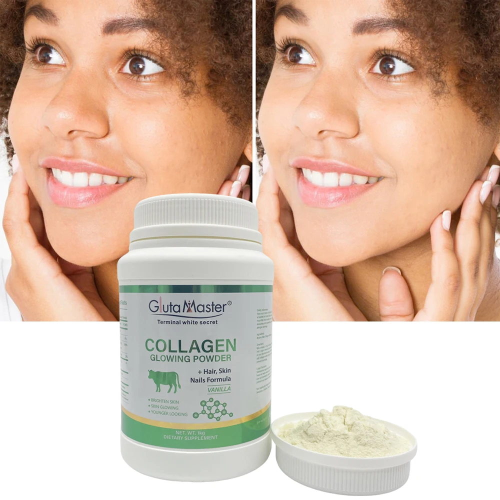 reduced glutathione injection Glutathione Collagen Glow Glutathione Collagen Glow Gummies Collagen  Gummies for Women Skin Care Korean Collagen Gummies to Rejuvenate Your Skin  (3PCS) | Buy Now with Express International Delivery