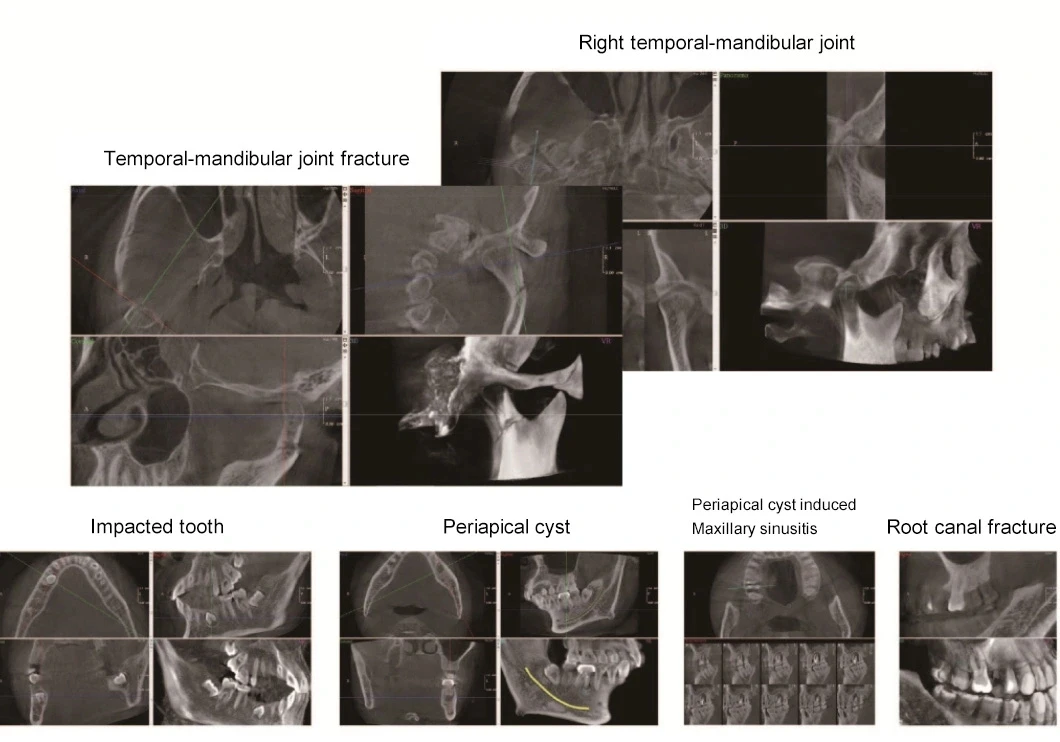 High Quality Digital Radiography 3D CBCT Panoramic Dental X-ray Machine, Teeth Xray Scanner factory