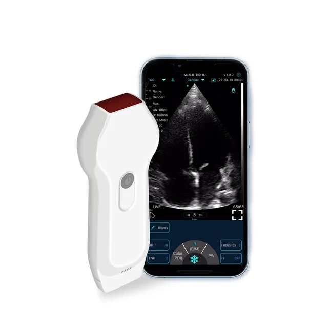 C10XL Doppler Portable Wifi&USB  Wireless Ultrasound  Linear&Cardiac Dual-probe Handheld Ultrasound